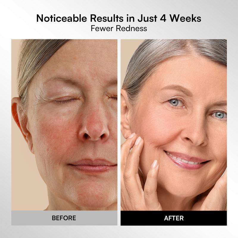 Selora Lumina™ LED Therapy Mask