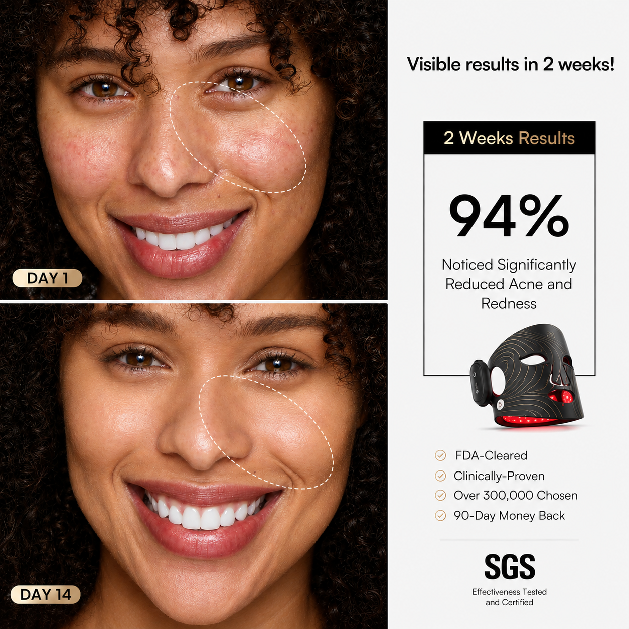 Selora Lumina™ LED Therapy Mask