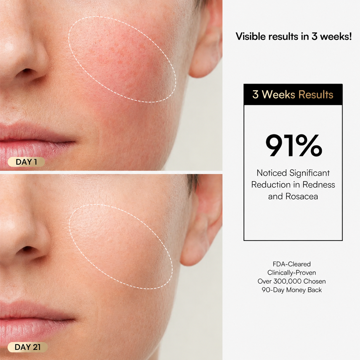 Selora Lumina™ LED Therapy Mask