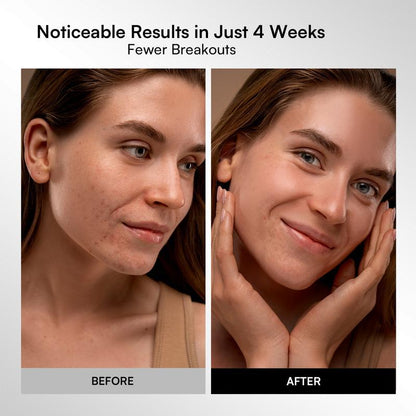 Selora Lumina™ LED Therapy Mask