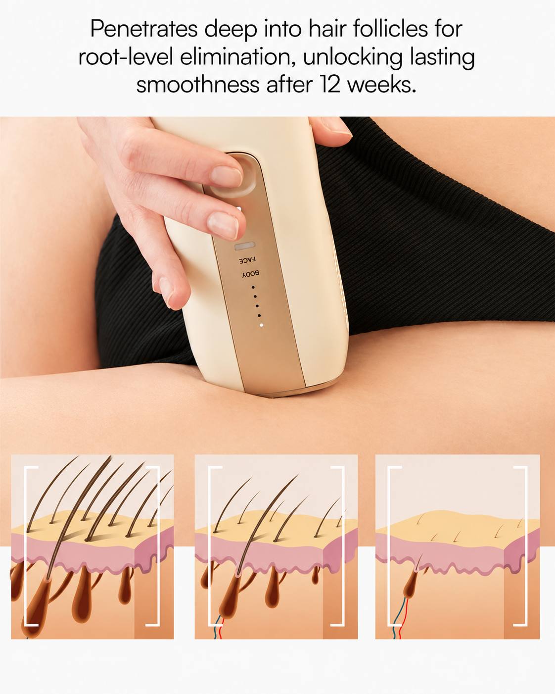 Selora Silk™ IPL Hair Removal Device